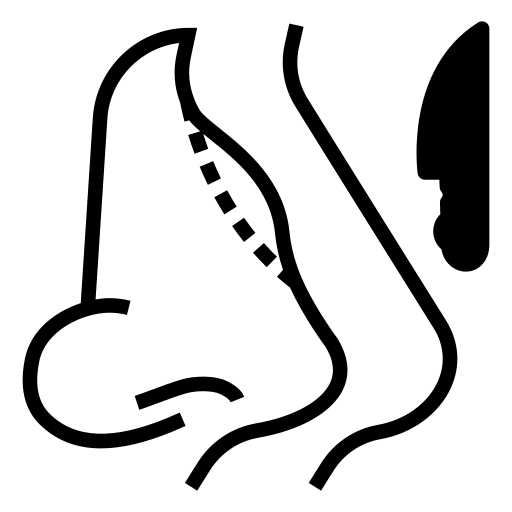Rinoplasti