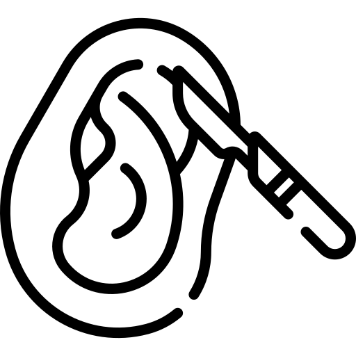 Timpanoplasti